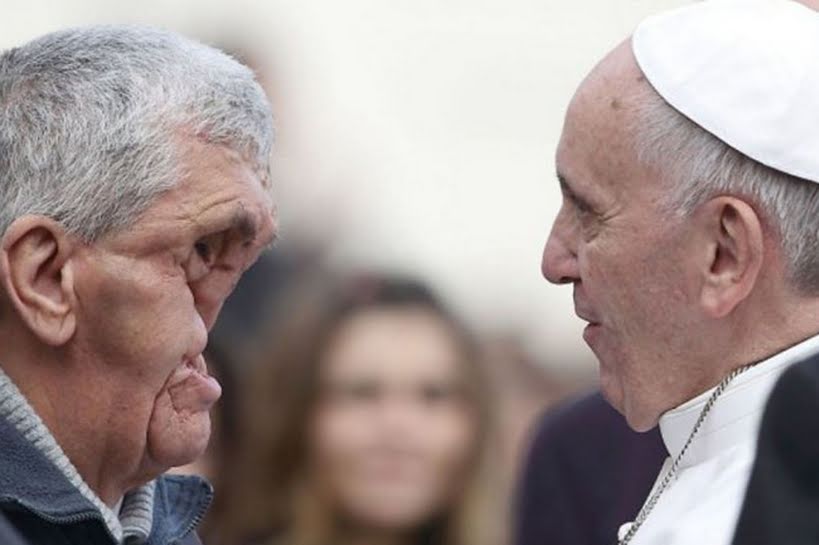Por que o Papa Francisco beija os doentes e deformados?