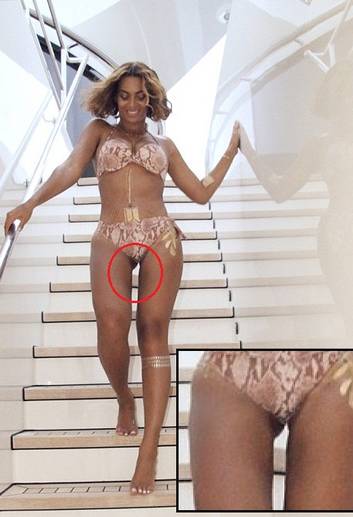Degrau desalinhado  "entrega " Photoshop exagerado para afinar perna de Beyoncé