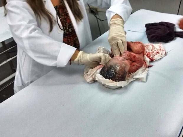 Mulher dá à luz no meio da rua e abandona bebê; mãe foi detida ensanguentada