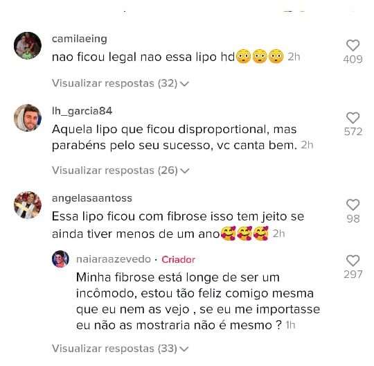 Naiara Azevedo tem corpo de biquíni criticado na web e rebate: "Fibrose não incomoda "